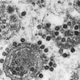 The Eastern equine encephalitis (EEE) virus, seen above infecting cells in the central nervous system.